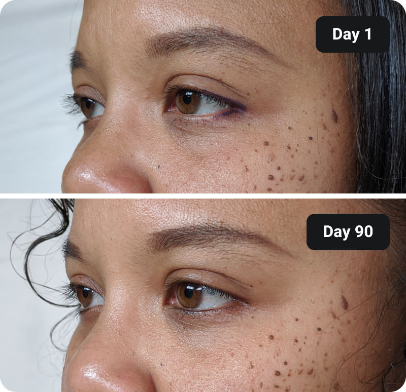 Collagen before and after results