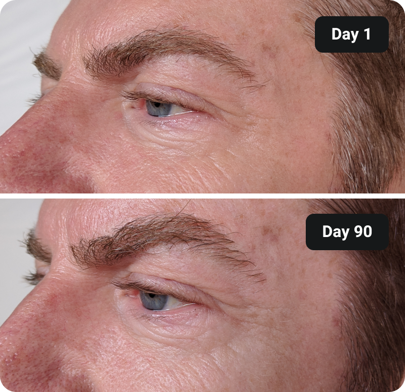 Collagen before and after results