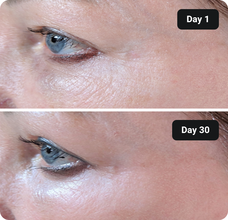Collagen before and after results
