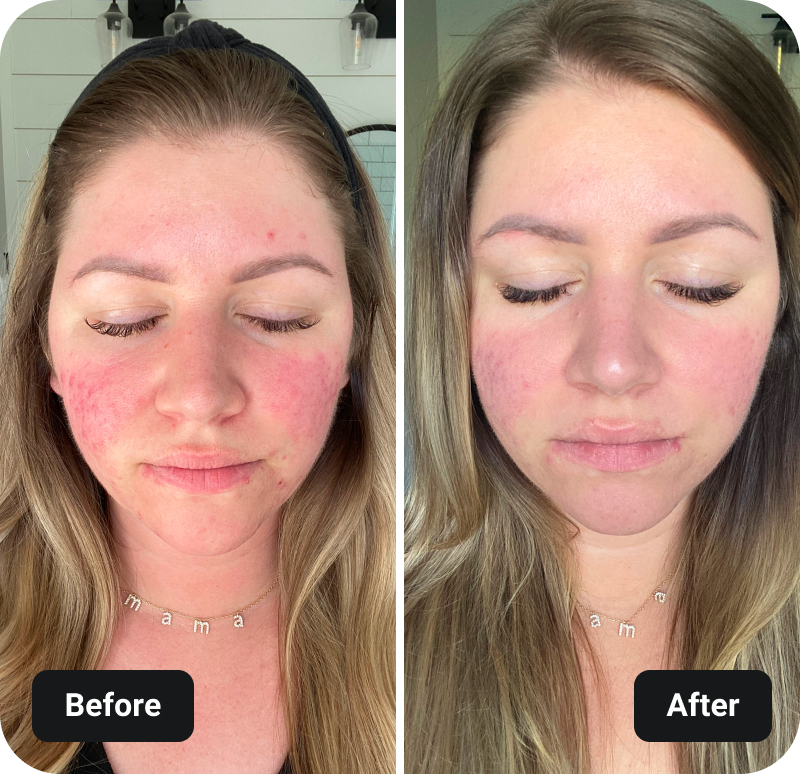 4 Week Gut Protocol before and after results